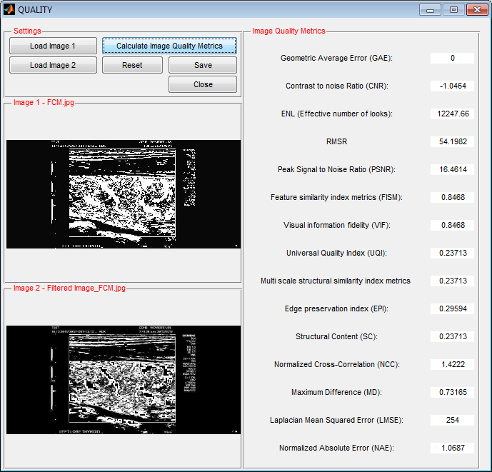PhD Projects in Medical Image Processing