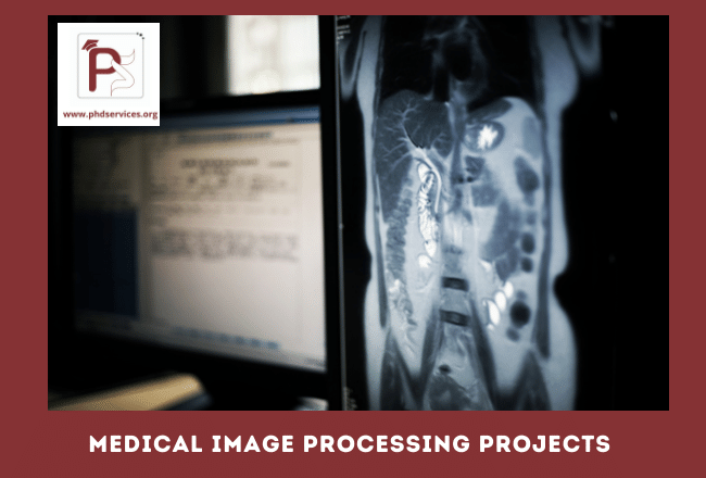Buy PhD Projects in Medical Image Processing Online
